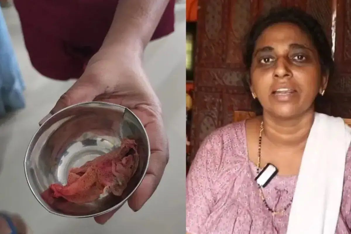 Surgical Sponge Left Inside Woman's Abdomen Sparks Clinical Negligence Allegations Against Kerala Hospital 1 Surgical Sponge Left Inside Woman's Abdomen Sparks Clinical Negligence Allegations Against Kerala Hospital